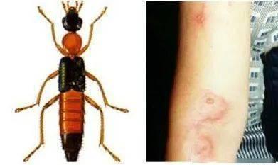 昆虫学者皮肤最新爆料蓝皮,蓝皮昆虫的神秘生成之谜